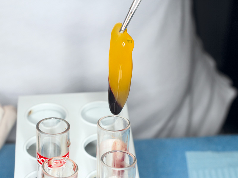 Biologisches Potenzial & Heilungsverlauf – Zahnärzte am Inn