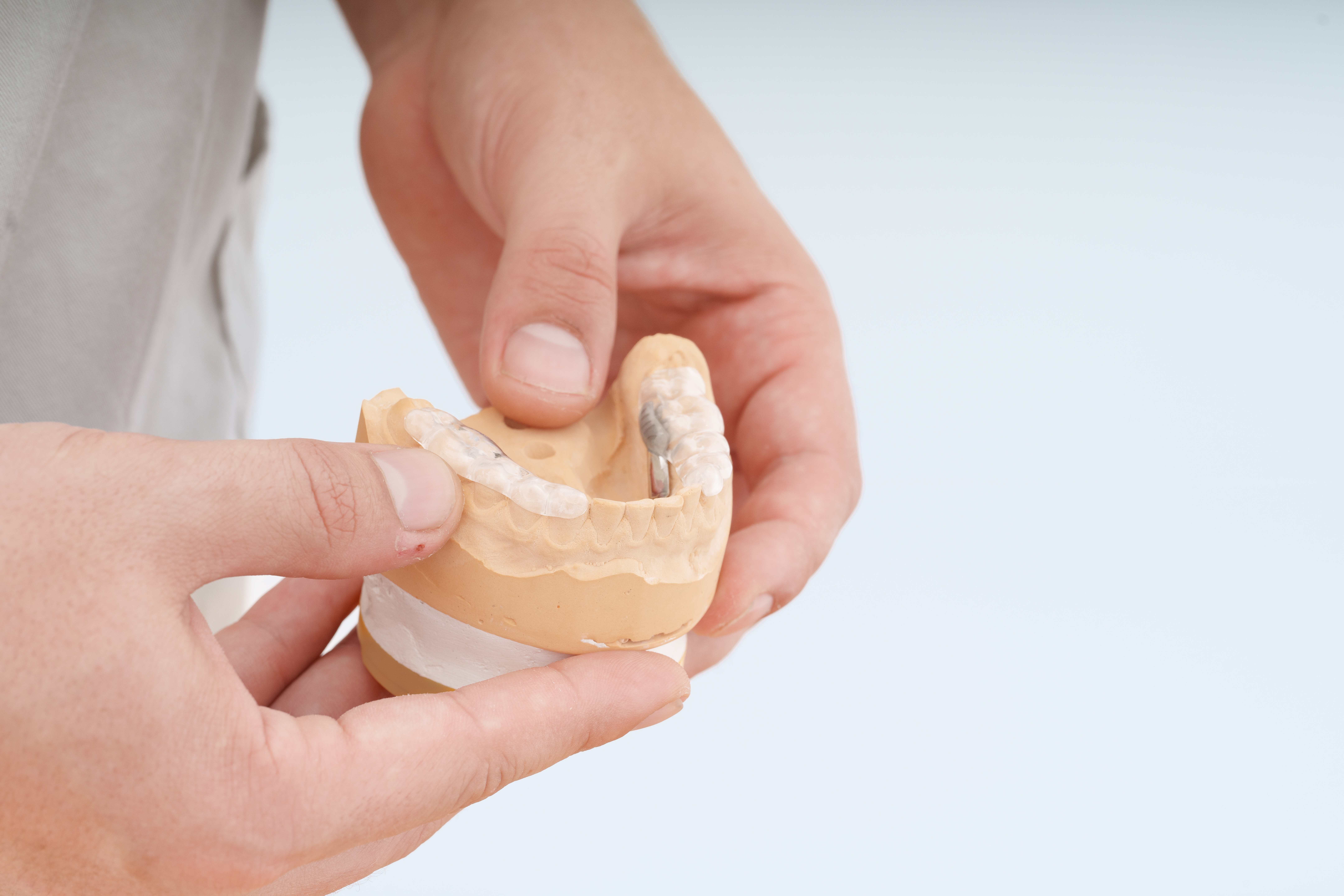 Festsitzender Zahnersatz – Maximale Stabilität & Komfort – Zahnärzte am Inn