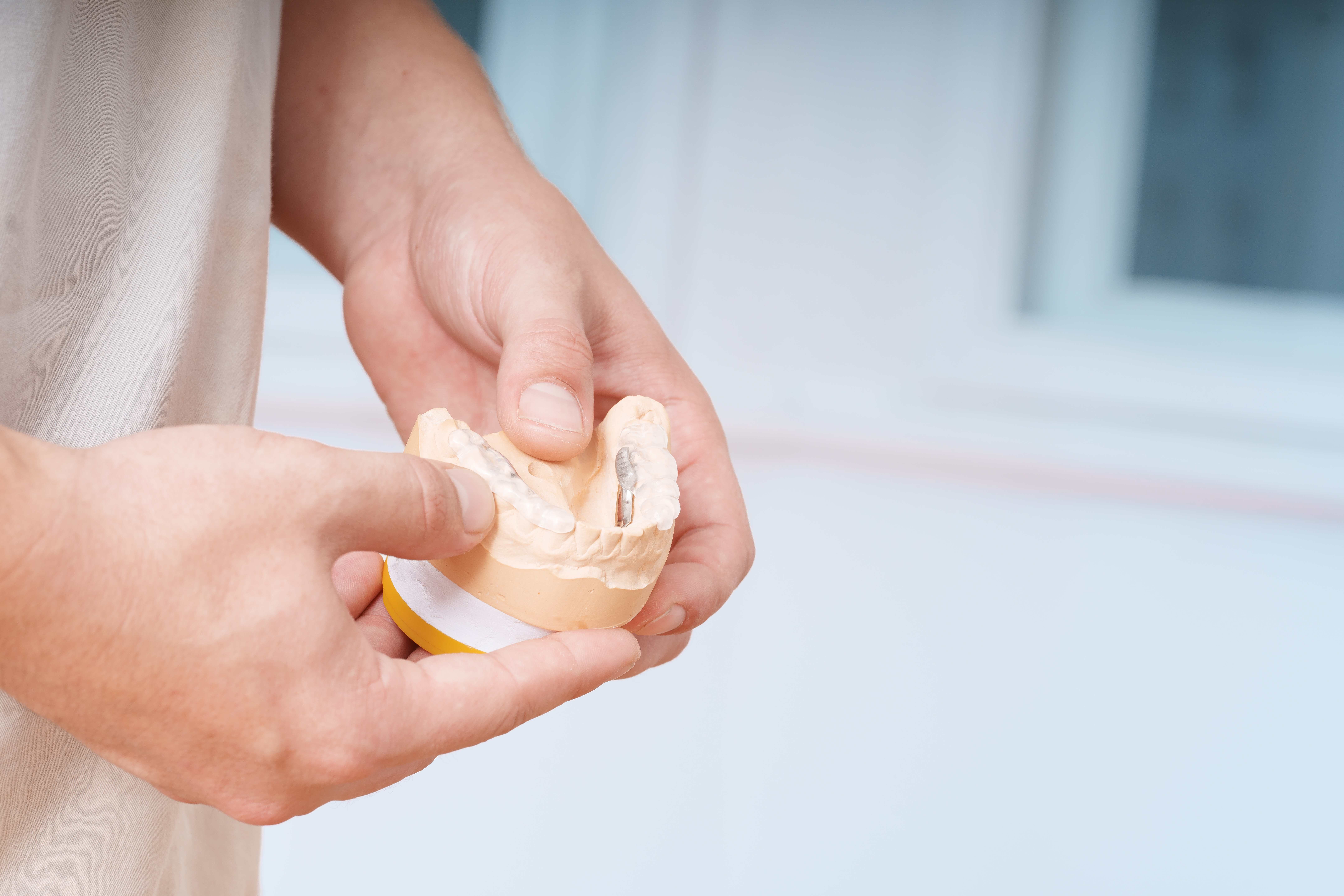 Unsere Implantate – Höchste Präzision & Langlebigkeit – Zahnärzte am Inn